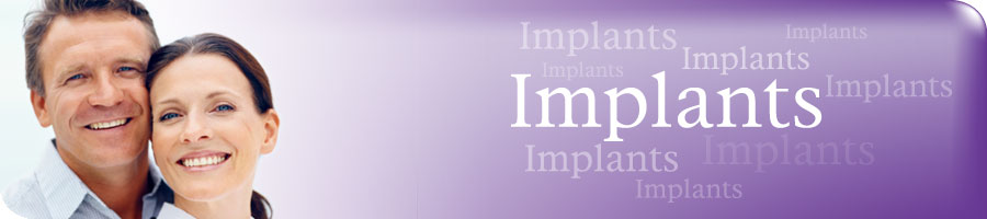 Dental Implants
